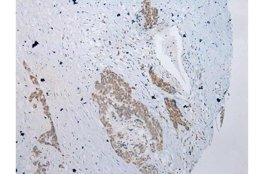 Immunohistochemistry - YY1AP1 Antibody from Signalway Antibody (42866) - Antibodies.com