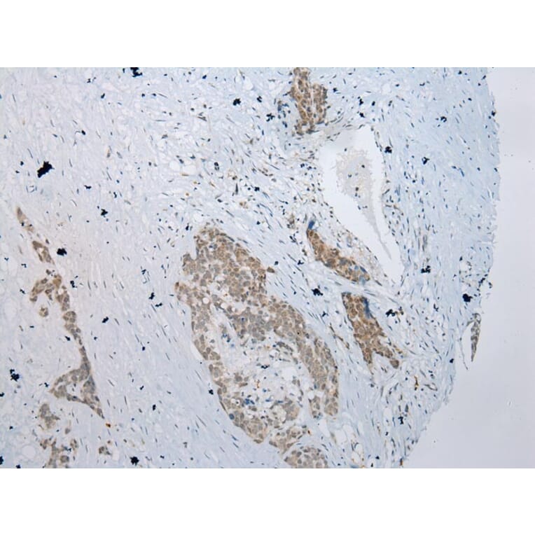 Immunohistochemistry - YY1AP1 Antibody from Signalway Antibody (42866) - Antibodies.com