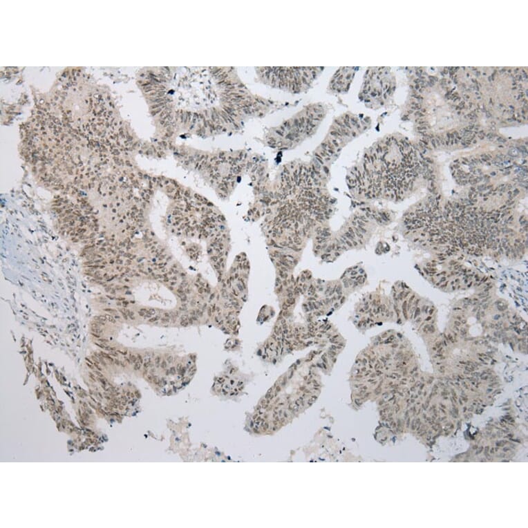 Immunohistochemistry - YY1AP1 Antibody from Signalway Antibody (42866) - Antibodies.com