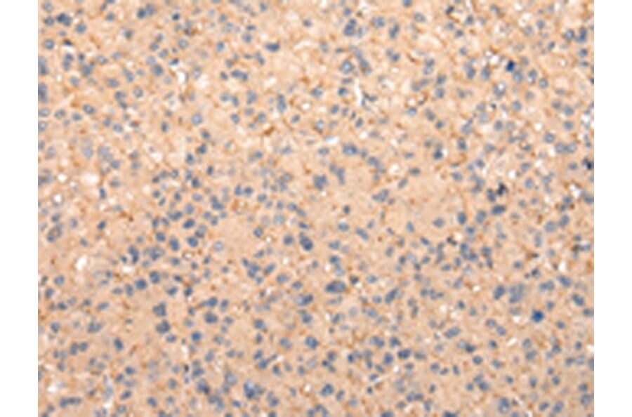 Immunohistochemistry - ZFAND1 Antibody from Signalway Antibody (42869) - Antibodies.com