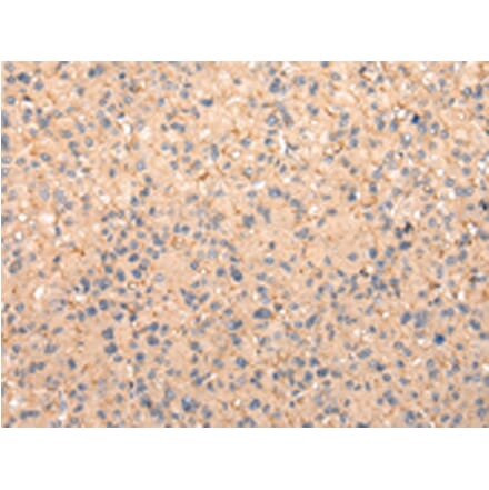 Immunohistochemistry - ZFAND1 Antibody from Signalway Antibody (42869) - Antibodies.com