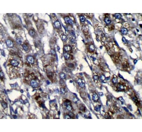 Immunohistochemistry - ZFAND3 Antibody from Signalway Antibody (42870) - Antibodies.com