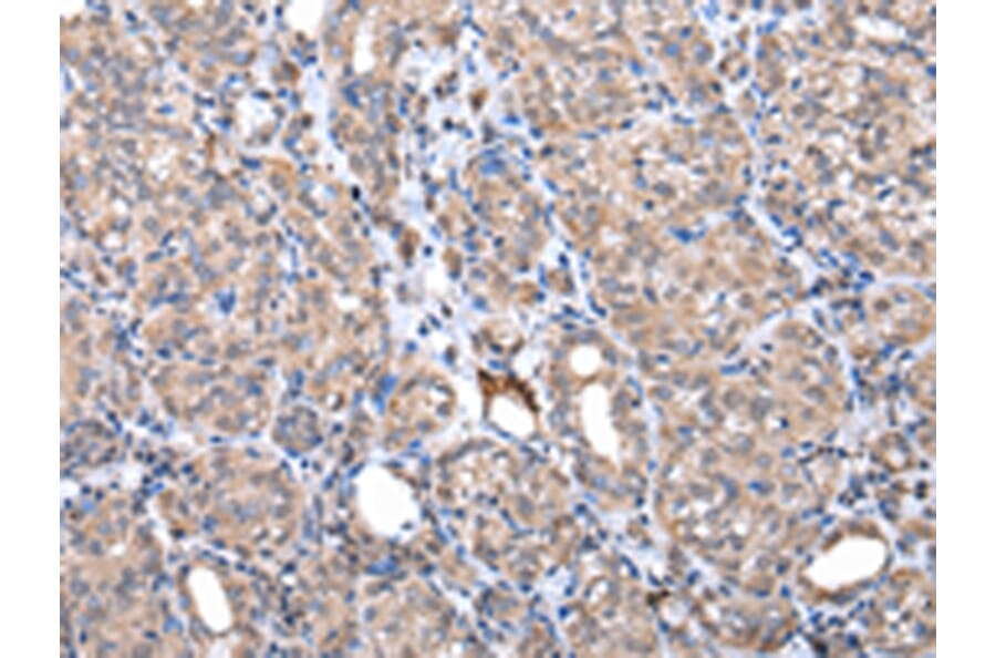 Immunohistochemistry - ZNF217 Antibody from Signalway Antibody (42875) - Antibodies.com