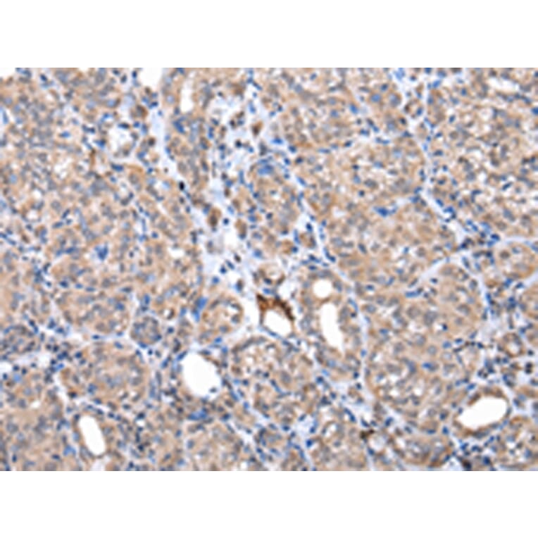 Immunohistochemistry - ZNF217 Antibody from Signalway Antibody (42875) - Antibodies.com