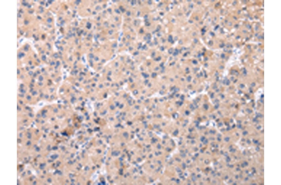 Immunohistochemistry - ZNF268 Antibody from Signalway Antibody (42877) - Antibodies.com