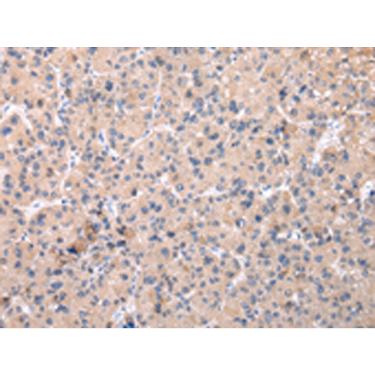 Immunohistochemistry - ZNF268 Antibody from Signalway Antibody (42877) - Antibodies.com