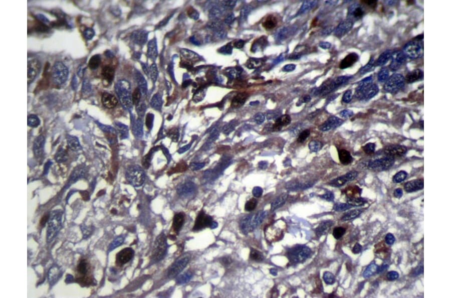 Immunohistochemistry - RNF115 Antibody from Signalway Antibody (42878) - Antibodies.com
