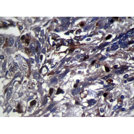 Immunohistochemistry - RNF115 Antibody from Signalway Antibody (42878) - Antibodies.com