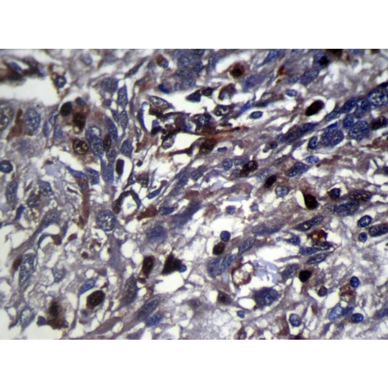 Immunohistochemistry - RNF115 Antibody from Signalway Antibody (42878) - Antibodies.com