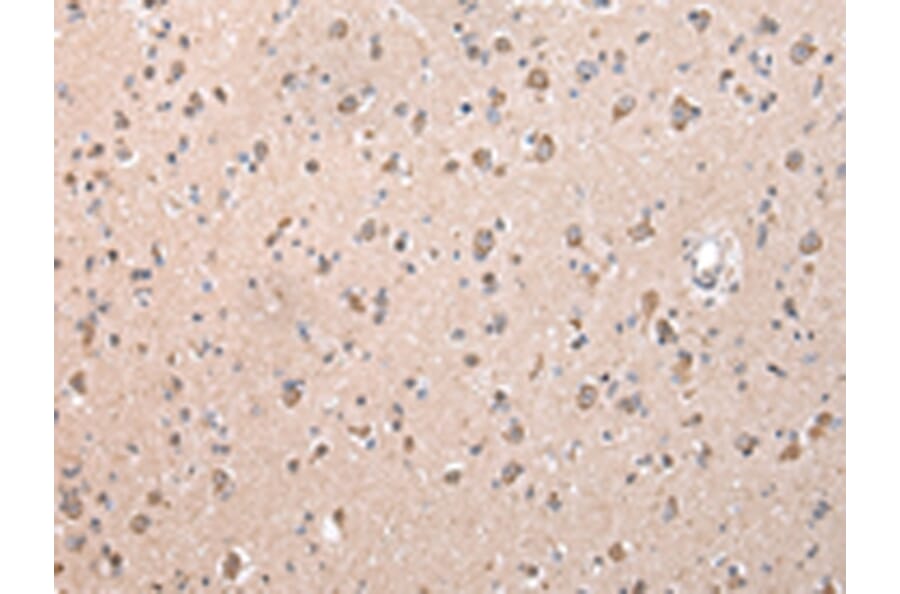 Immunohistochemistry - ZCCHC9 Antibody from Signalway Antibody (42879) - Antibodies.com