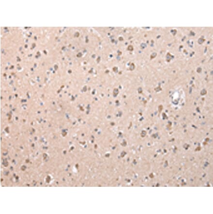 Immunohistochemistry - ZCCHC9 Antibody from Signalway Antibody (42879) - Antibodies.com