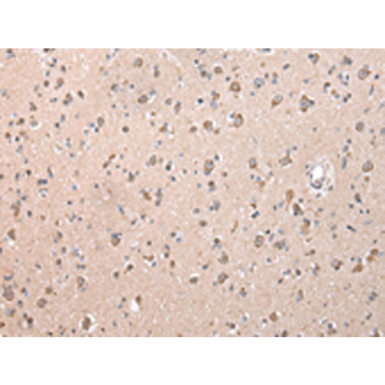 Immunohistochemistry - ZCCHC9 Antibody from Signalway Antibody (42879) - Antibodies.com