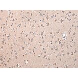 Immunohistochemistry - ZCCHC9 Antibody from Signalway Antibody (42879) - Antibodies.com