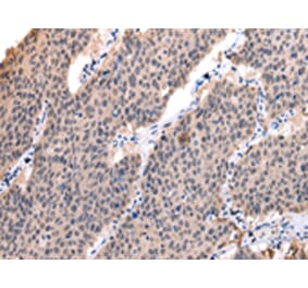 Immunohistochemistry - POLR2K Antibody from Signalway Antibody (42880) - Antibodies.com