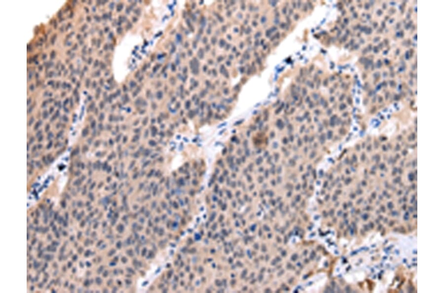 Immunohistochemistry - POLR2K Antibody from Signalway Antibody (42880) - Antibodies.com