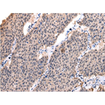 Immunohistochemistry - POLR2K Antibody from Signalway Antibody (42880) - Antibodies.com