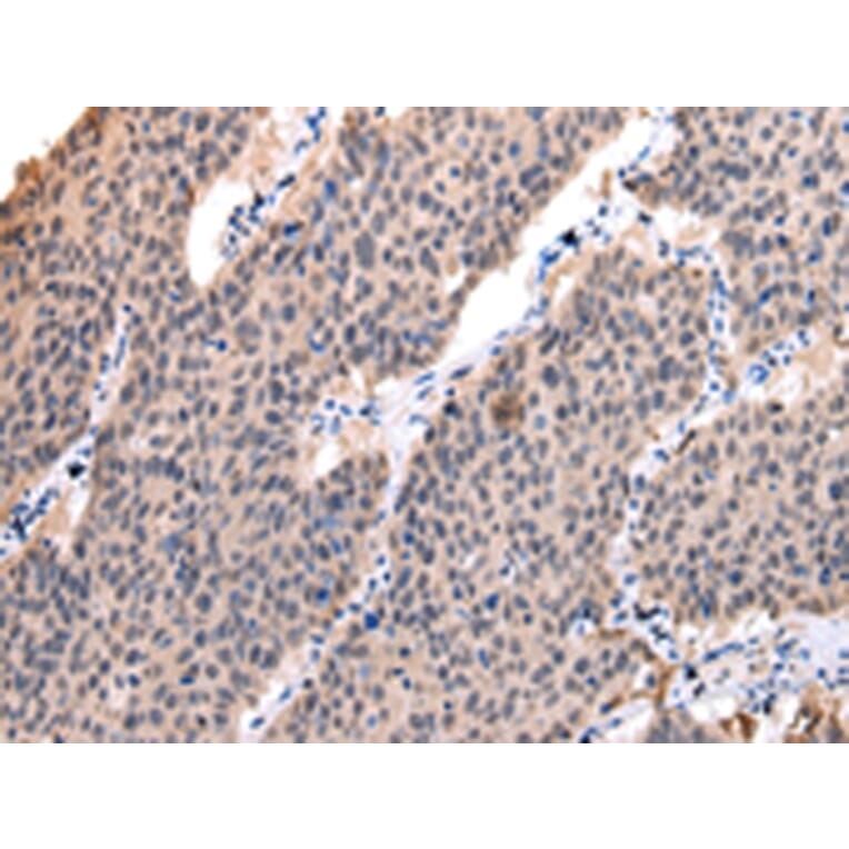 Immunohistochemistry - POLR2K Antibody from Signalway Antibody (42880) - Antibodies.com