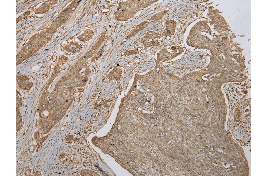 Immunohistochemistry - FNDC3B Antibody from Signalway Antibody (42886) - Antibodies.com