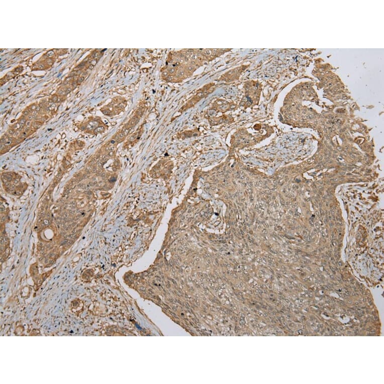Immunohistochemistry - FNDC3B Antibody from Signalway Antibody (42886) - Antibodies.com
