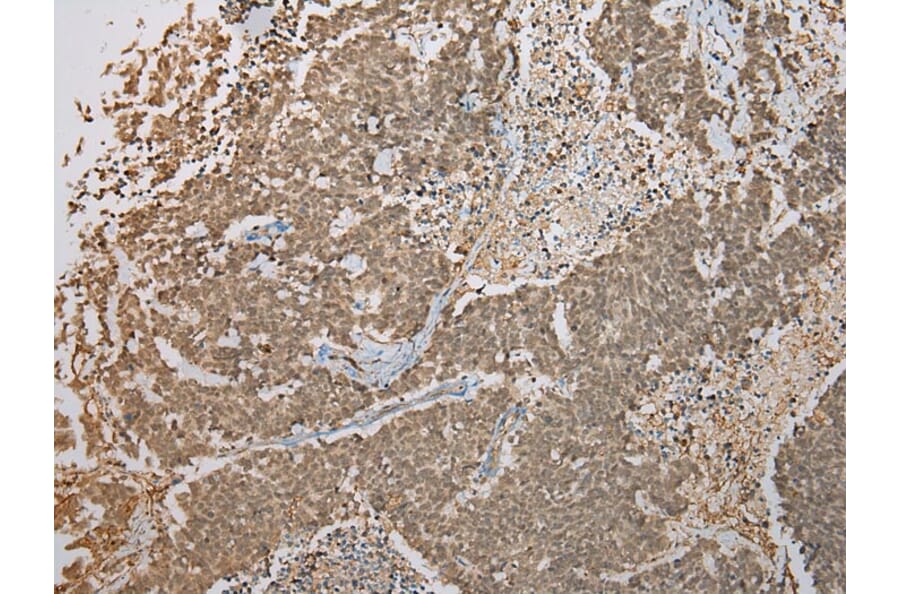 Immunohistochemistry - FNDC3B Antibody from Signalway Antibody (42886) - Antibodies.com
