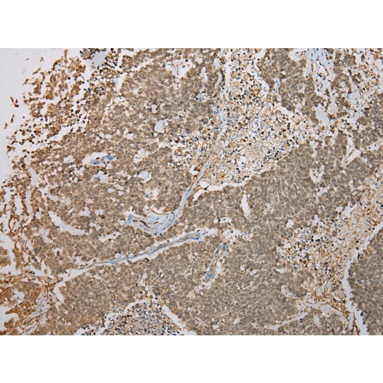 Immunohistochemistry - FNDC3B Antibody from Signalway Antibody (42886) - Antibodies.com