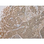 Immunohistochemistry - FNDC3B Antibody from Signalway Antibody (42886) - Antibodies.com