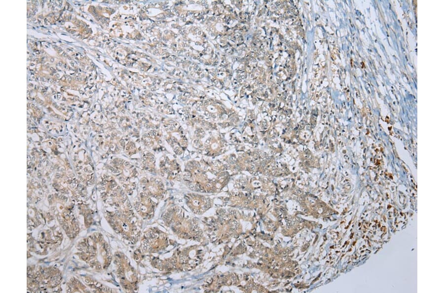 Immunohistochemistry - MLLT11 Antibody from Signalway Antibody (42891) - Antibodies.com
