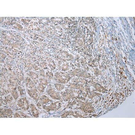 Immunohistochemistry - MLLT11 Antibody from Signalway Antibody (42891) - Antibodies.com
