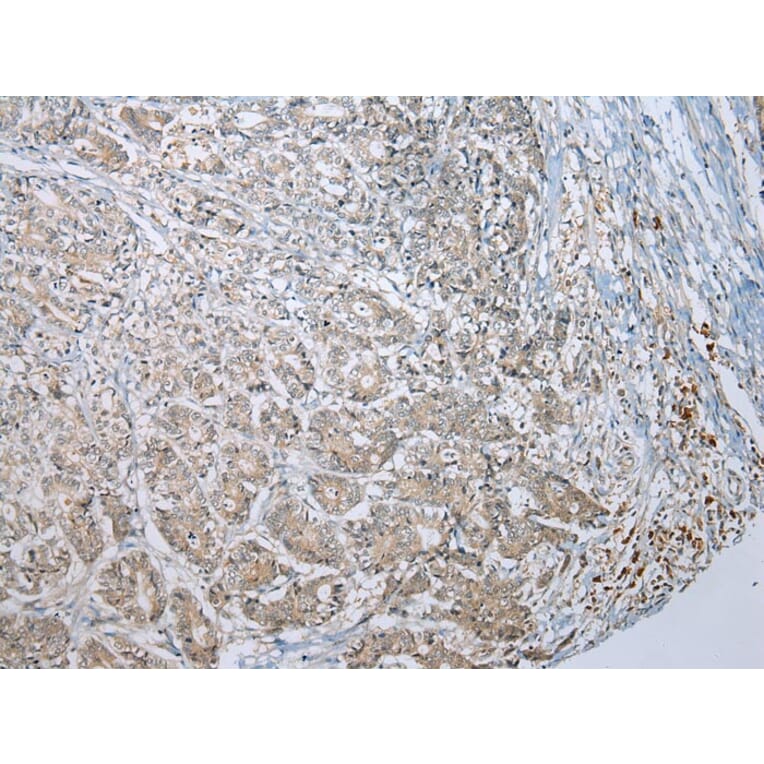 Immunohistochemistry - MLLT11 Antibody from Signalway Antibody (42891) - Antibodies.com