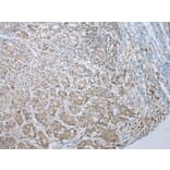 Immunohistochemistry - MLLT11 Antibody from Signalway Antibody (42891) - Antibodies.com