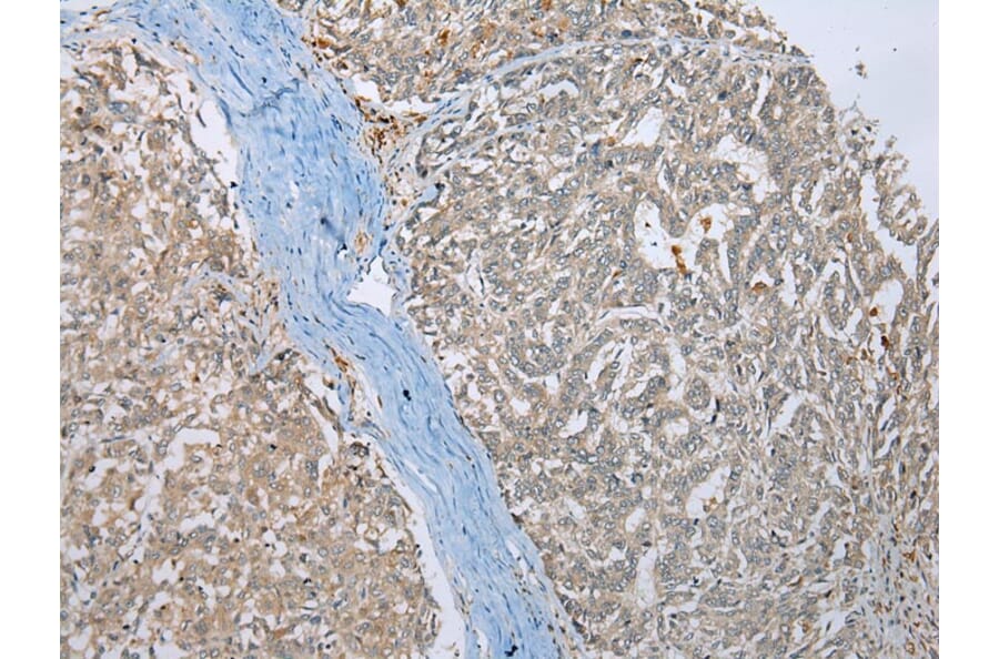 Immunohistochemistry - MLLT11 Antibody from Signalway Antibody (42891) - Antibodies.com