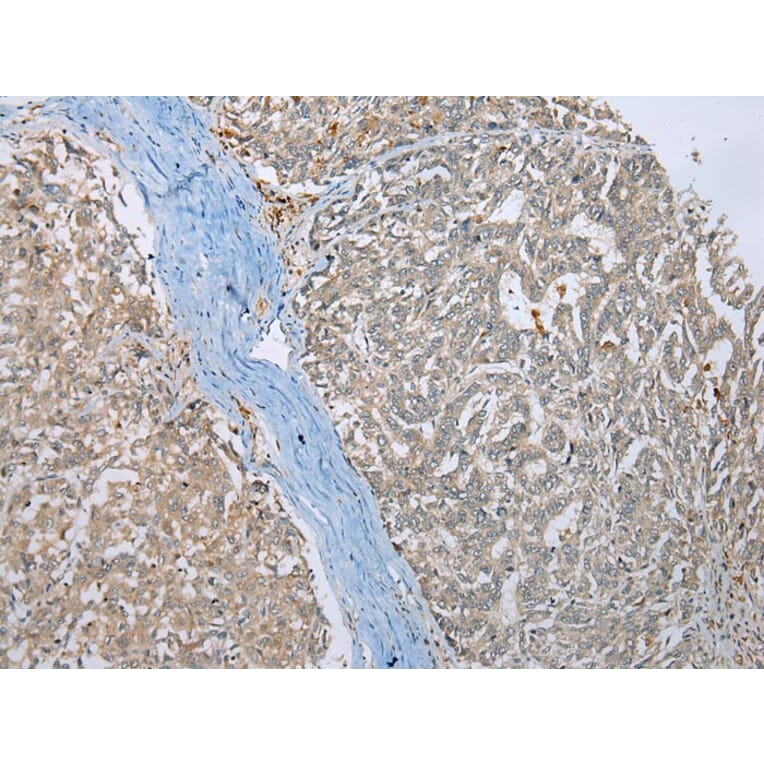 Immunohistochemistry - MLLT11 Antibody from Signalway Antibody (42891) - Antibodies.com