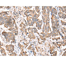 Immunohistochemistry - RABL2B Antibody from Signalway Antibody (42892) - Antibodies.com
