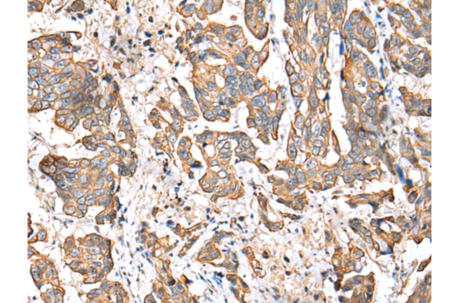 Immunohistochemistry - RABL2B Antibody from Signalway Antibody (42892) - Antibodies.com