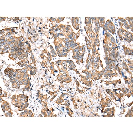 Immunohistochemistry - RABL2B Antibody from Signalway Antibody (42892) - Antibodies.com