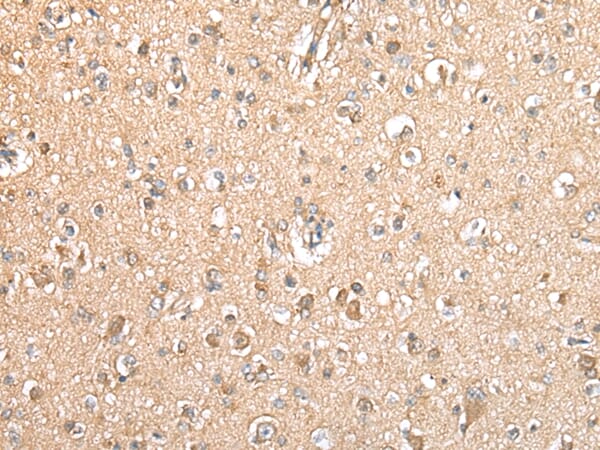 Immunohistochemical analysis of paraffin-embedded Human brain tissue using #42901 at dilution 1/20,