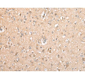 Immunohistochemistry - TYROBP Antibody from Signalway Antibody (42901) - Antibodies.com