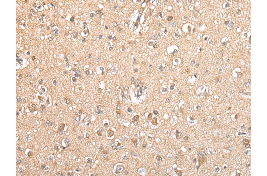 Immunohistochemistry - TYROBP Antibody from Signalway Antibody (42901) - Antibodies.com
