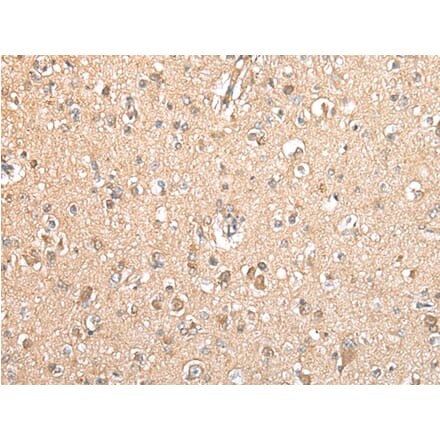 Immunohistochemistry - TYROBP Antibody from Signalway Antibody (42901) - Antibodies.com