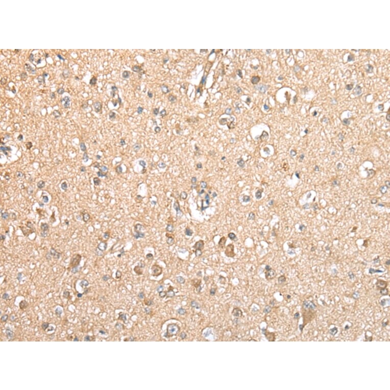 Immunohistochemistry - TYROBP Antibody from Signalway Antibody (42901) - Antibodies.com