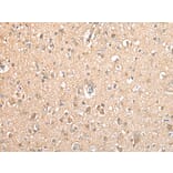 Immunohistochemistry - TYROBP Antibody from Signalway Antibody (42901) - Antibodies.com