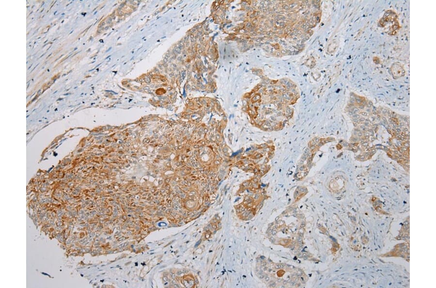Immunohistochemistry - KRT222 Antibody from Signalway Antibody (42902) - Antibodies.com