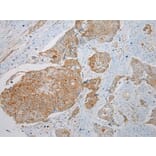 Immunohistochemistry - KRT222 Antibody from Signalway Antibody (42902) - Antibodies.com