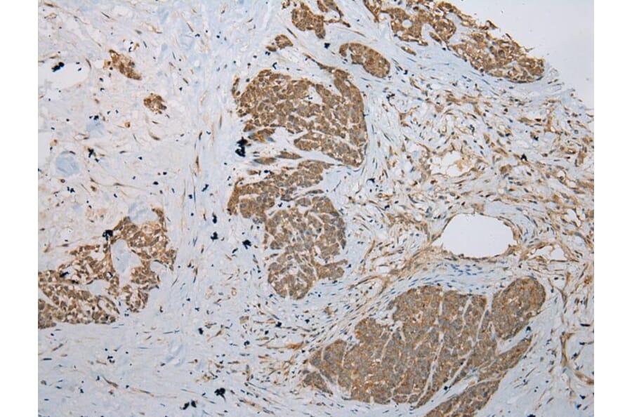 Immunohistochemistry - KRT222 Antibody from Signalway Antibody (42902) - Antibodies.com