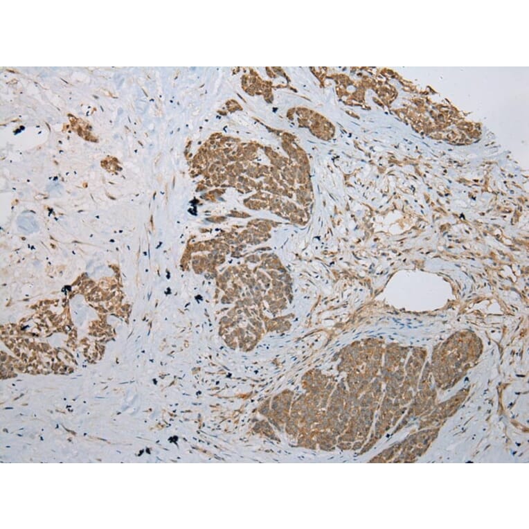 Immunohistochemistry - KRT222 Antibody from Signalway Antibody (42902) - Antibodies.com