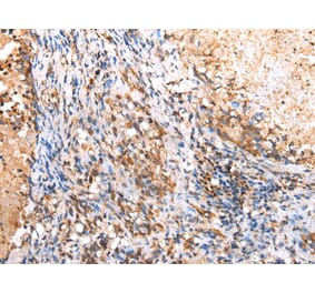 Immunohistochemistry - RIMKLB Antibody from Signalway Antibody (42904) - Antibodies.com