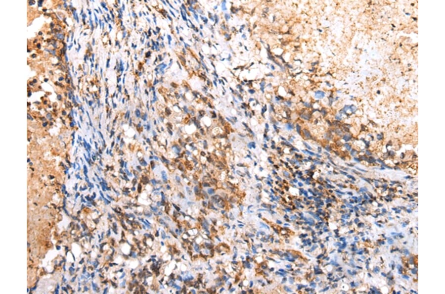 Immunohistochemistry - RIMKLB Antibody from Signalway Antibody (42904) - Antibodies.com