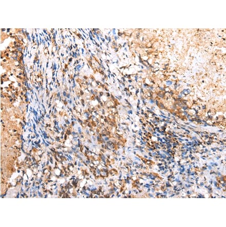 Immunohistochemistry - RIMKLB Antibody from Signalway Antibody (42904) - Antibodies.com