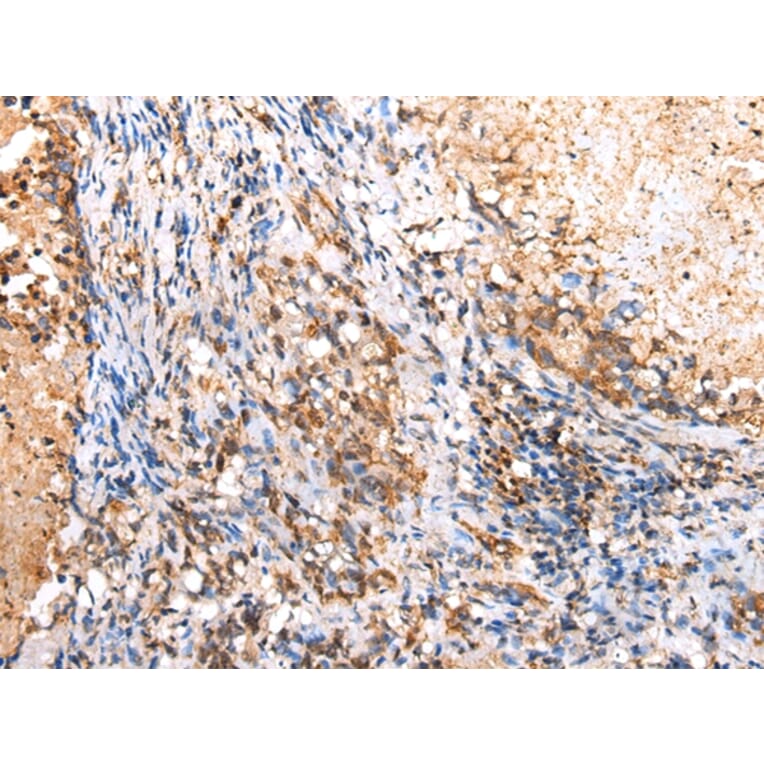 Immunohistochemistry - RIMKLB Antibody from Signalway Antibody (42904) - Antibodies.com