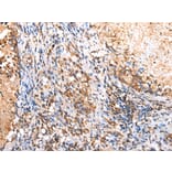 Immunohistochemistry - RIMKLB Antibody from Signalway Antibody (42904) - Antibodies.com